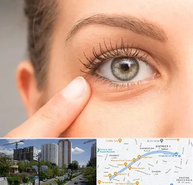 جراح پف چشم در اندرزگو