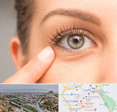 جراح پف چشم در معالی آباد شیراز