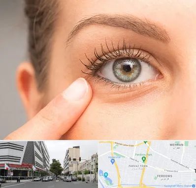 جراح پف چشم در بلوار فردوس 