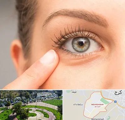 جراح پف چشم در مهرشهر کرج 
