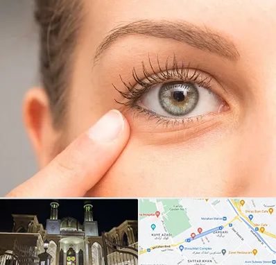 جراح پف چشم در زرگری شیراز