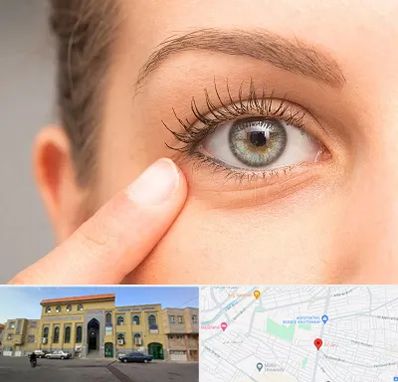 جراح پف چشم در زنبیل آباد قم