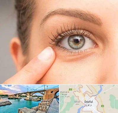 جراح پف چشم در دزفول