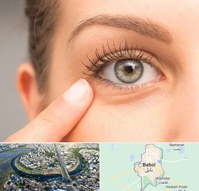 جراح پف چشم در بابل