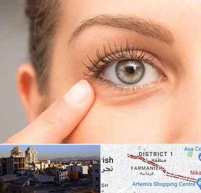 جراح پف چشم در فرمانیه 