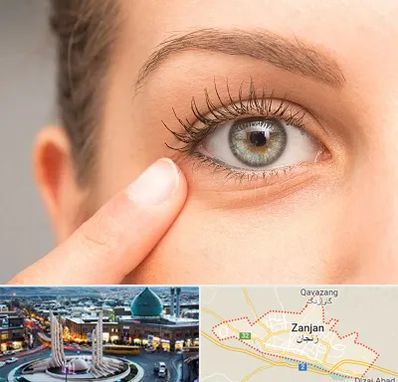 جراح پف چشم در زنجان