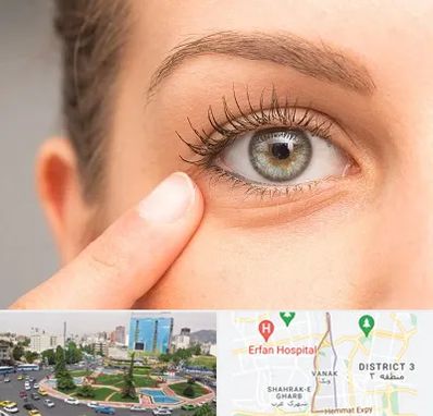 جراح پف چشم در ونک 