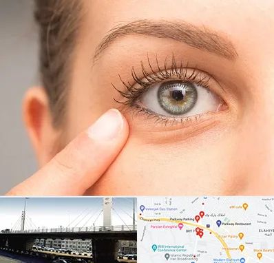 جراح پف چشم در پارک وی 