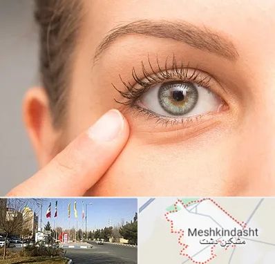 جراح پف چشم در مشکین دشت