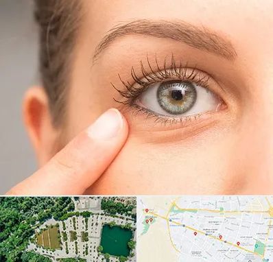 جراح پف چشم در وکیل آباد مشهد 