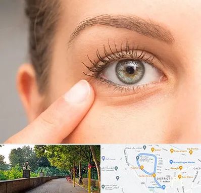 جراح پف چشم در فلکه گاز رشت