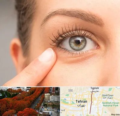 جراح پف چشم در ولیعصر 