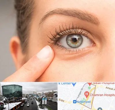جراح پف چشم در اقدسیه 