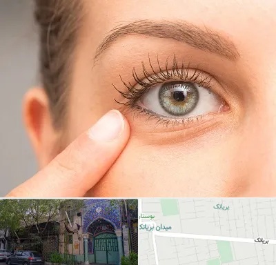 جراح پف چشم در بریانک