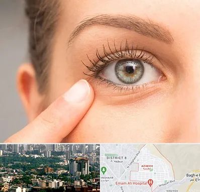 جراح پف چشم در عظیمیه کرج 