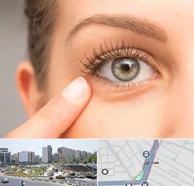 جراح پف چشم در هفت تیر