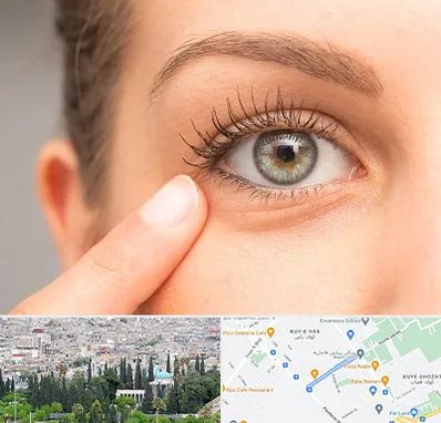 جراح پف چشم در محلاتی شیراز