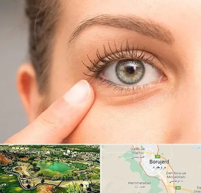 جراح پف چشم در بروجرد