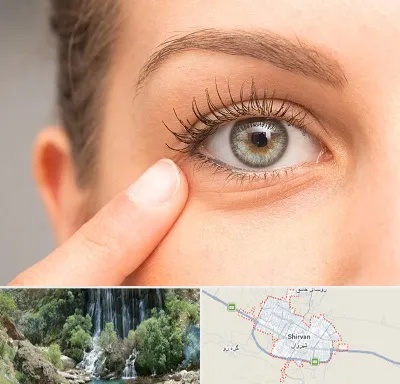 جراح پف چشم در شیروان