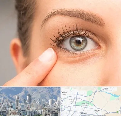 جراح پف چشم در شمال شرق تهران