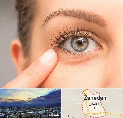 جراح پف چشم در زاهدان