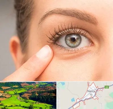 جراح پف چشم در نکا