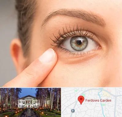 جراح پف چشم در باغ فردوس