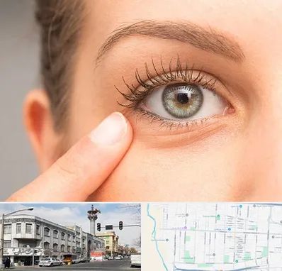 جراح پف چشم در 17شهریور