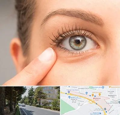 جراح پف چشم در مهرویلا کرج
