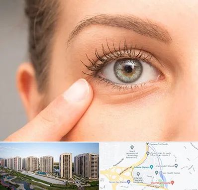 جراح پف چشم در المپیک 