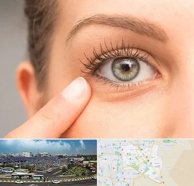 جراح پف چشم در منطقه 15 تهران 