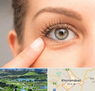 جراح پف چشم در خرم آباد