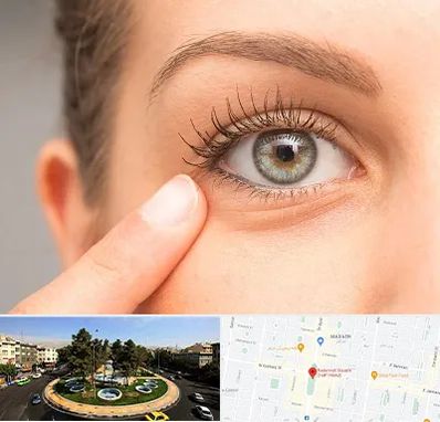 جراح پف چشم در هفت حوض 