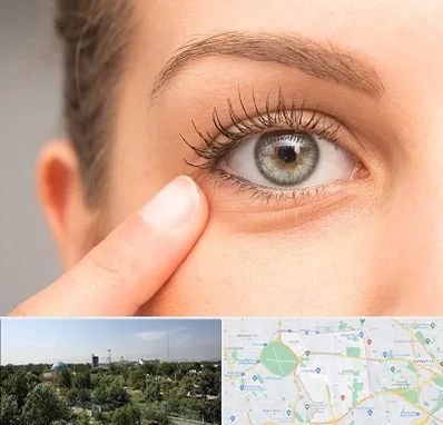 جراح پف چشم در منطقه 16 تهران 