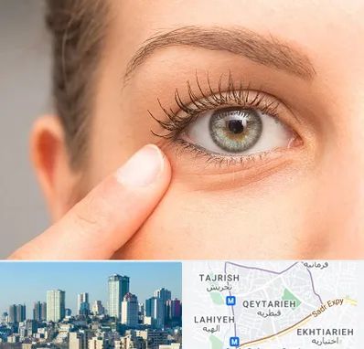 جراح پف چشم در قیطریه 