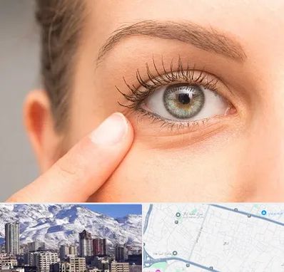 جراح پف چشم در ازگل