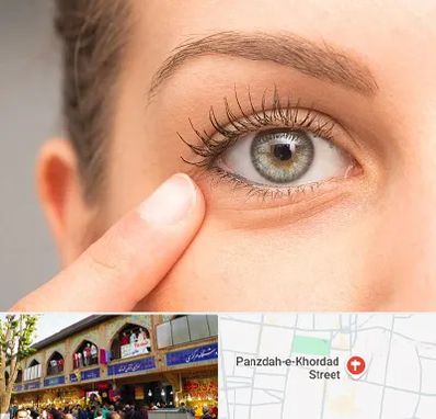جراح پف چشم در 15 خرداد