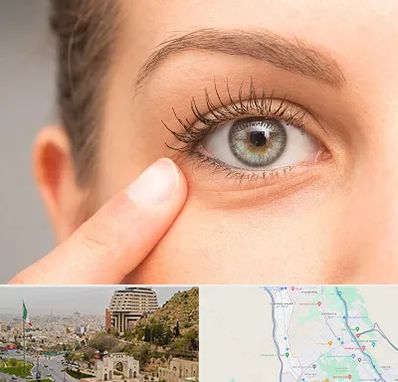 جراح پف چشم در فرهنگ شهر شیراز