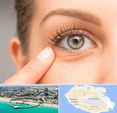 جراح پف چشم در کیش