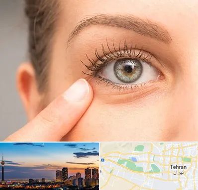 جراح پف چشم در غرب تهران 