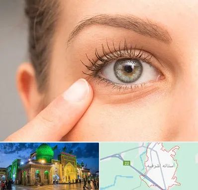 جراح پف چشم در آستانه اشرفیه