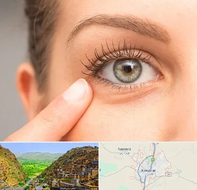 جراح پف چشم در کامیاران