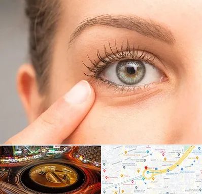 جراح پف چشم در میدان ولیعصر 