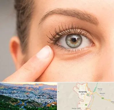 جراح پف چشم در سنندج