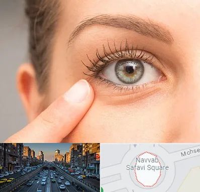 جراح پف چشم در نواب