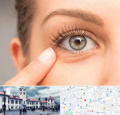 جراح پف چشم در میدان شهرداری رشت