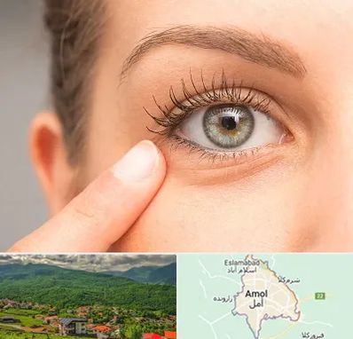 جراح پف چشم در آمل
