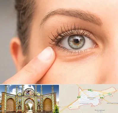 جراح پف چشم در سمنان