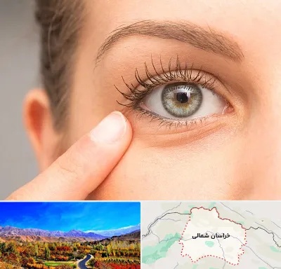 جراح پف چشم در خراسان شمالی