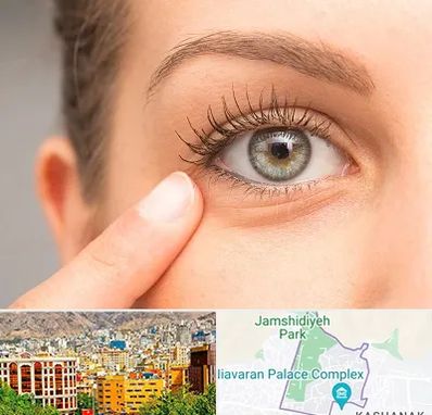 جراح پف چشم در نیاوران 